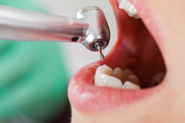 Best Emergency Treatment for Toothache in Williston Park, NY